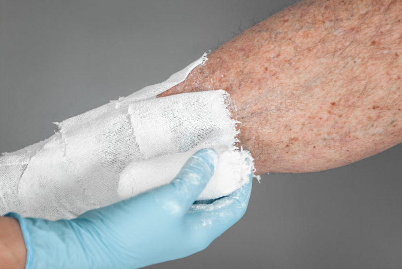 Zinc Oxide and Skin Integrity